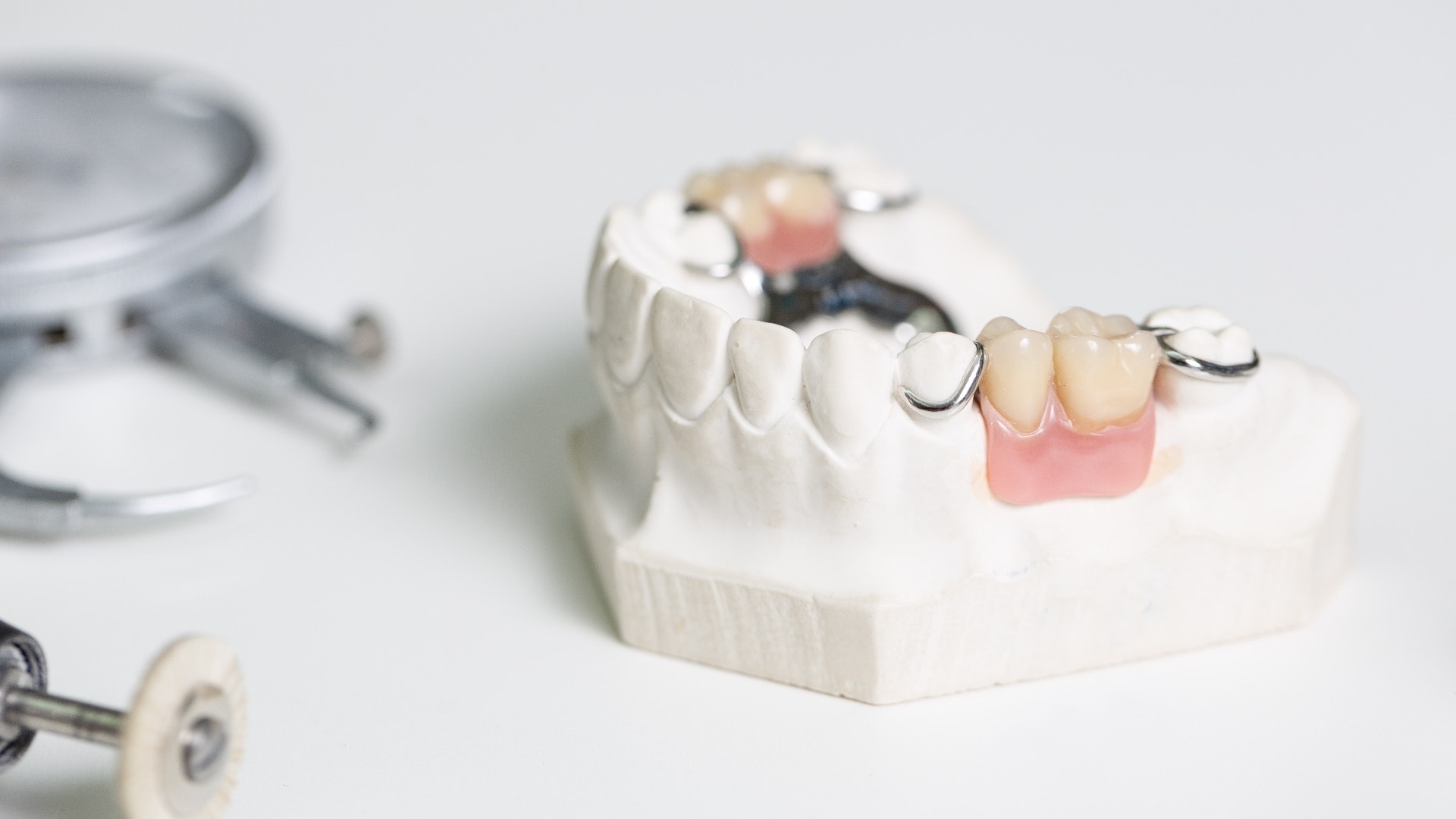 Dental imprint with artificial dentition in a dental laboratory