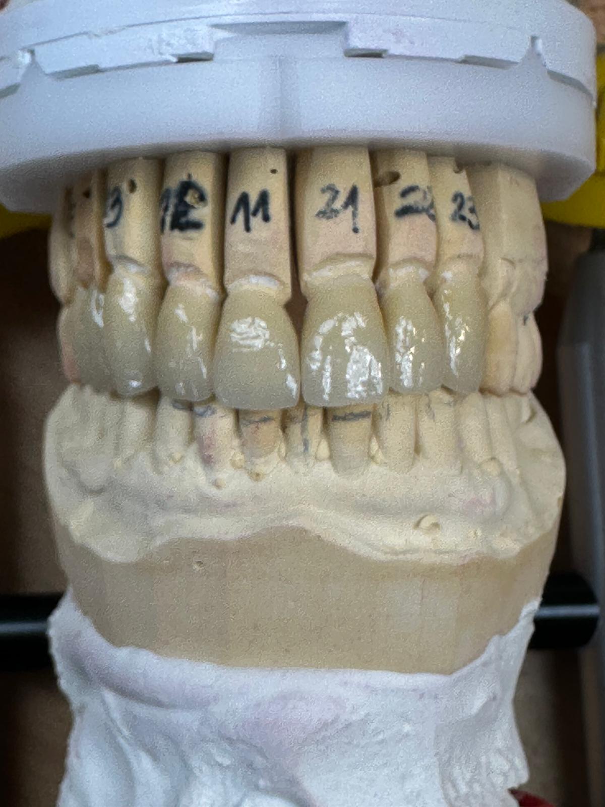 Dentalmodell mit nummerierten Zähnen, beige und grau, interessante Zahnfarbe und -form.